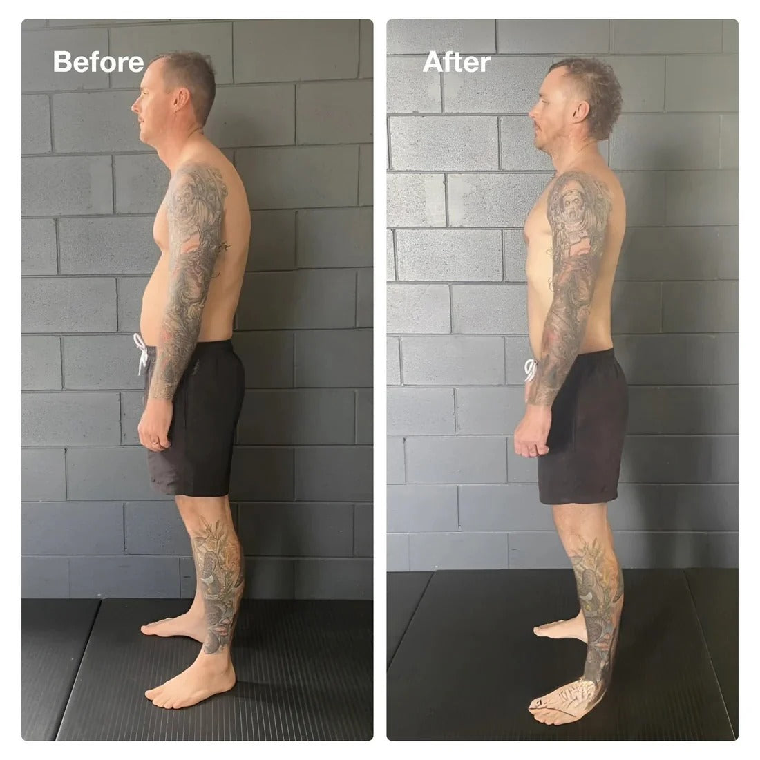 The Science Behind Posturix™: How It Corrects Posture and Alleviates Pain